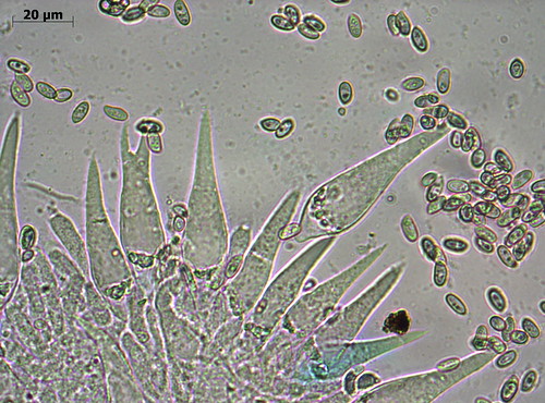 Macrocystidia cucumis - cheilocystidiaАвтор - Татьяна Бульонкова (Новосибирск)
 Источник: flickr Автор фото: Татьяна Бульонкова