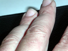 палец на руке