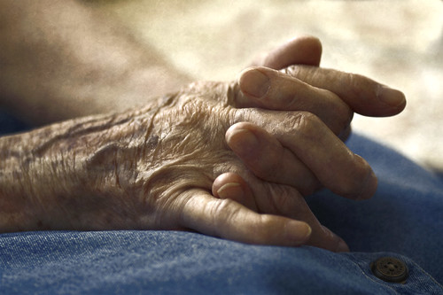 Can you prevent arthritis?