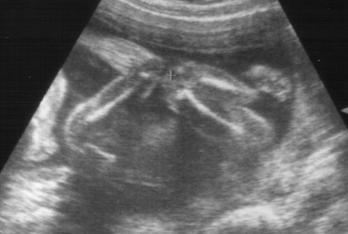 family ultrasound baby2