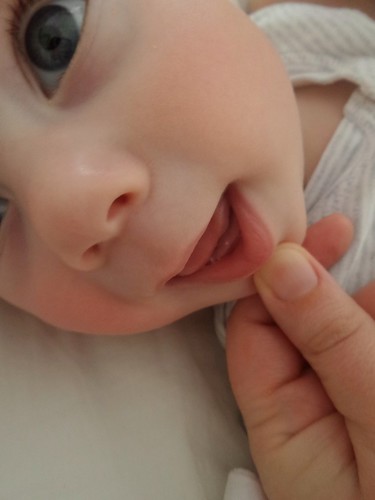 a strangely angled closeup of a baby's face. An adult thumb gently pulls down the lower lip and a small white dot is visible on the baby's lower gums