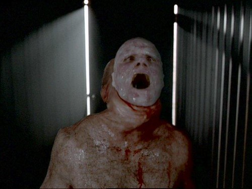 The X-Files - S04 - Leonard Betts