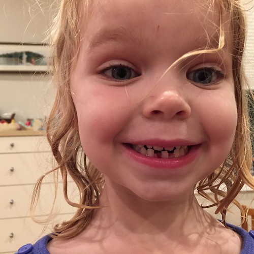Nora's 1st Lost Tooth