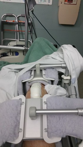 hospital replacement knee newknee marshallhospital