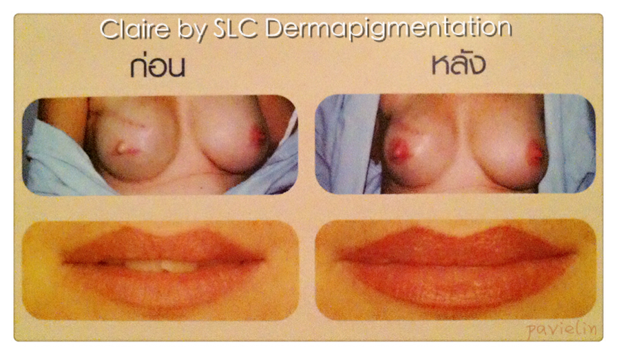 Claire by Siam Laser Clinic Bangkok Thailand SLC Contour Micropigmentation Dermapigmentation Eyelash Extension Technique