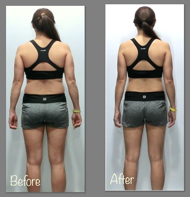 Back View - Before and after weight-loss comparison.