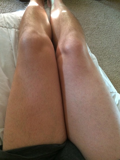 13 Knees That Look Like Shit