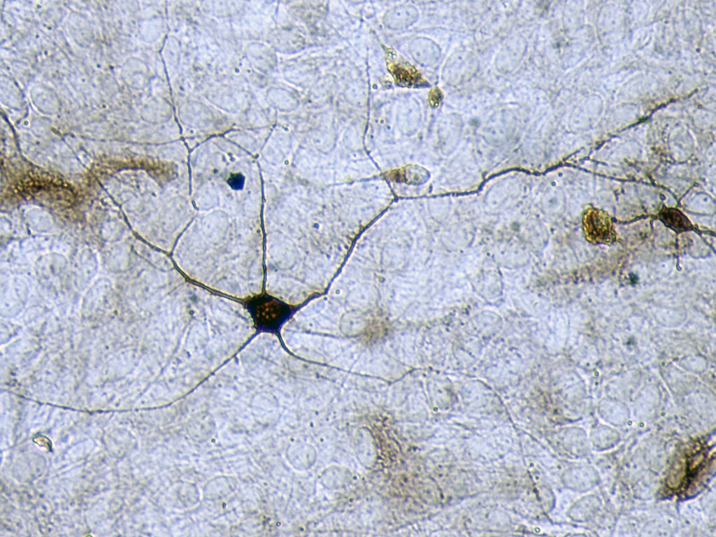 Neurona Hipocampo