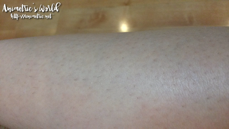 Laser Hair Removal at Wink