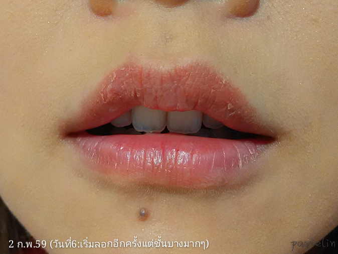 #Claire by #slc #Micropigmentation #liptattoo #beautyblogger