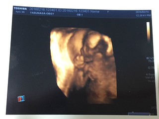 エコー写真　妊娠５ヵ月