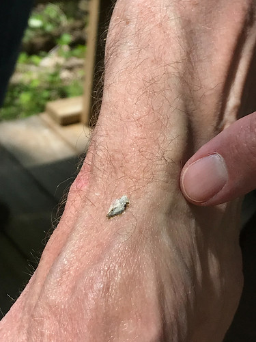 Cerulean Warbler Poop! On Curt Rawn's hand!
