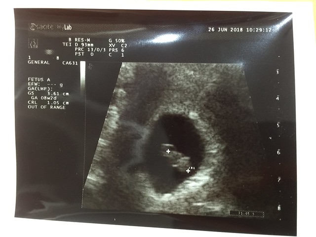 三寶-懷孕八週