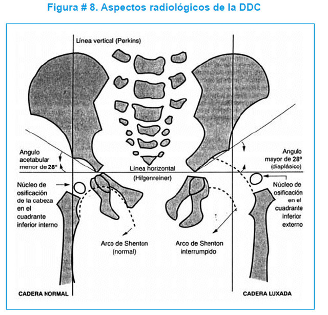 DDC - Aspectos Radiológicos de la DDC