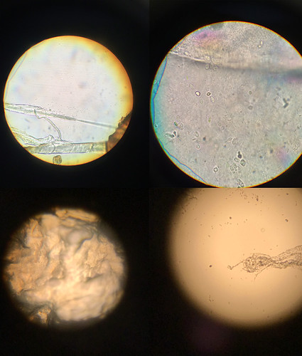 SCOBY Under the Microscope
