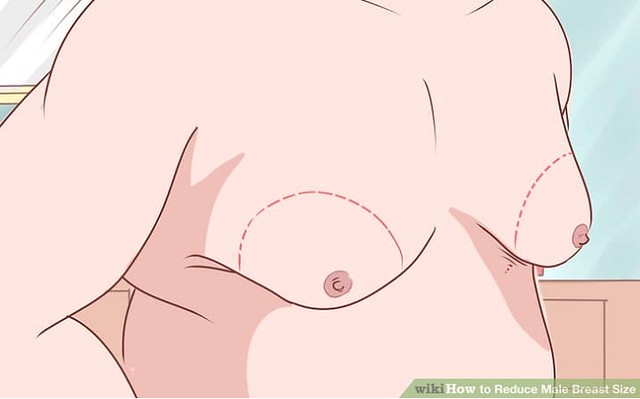 2600 3 Simple Tips to reduce Male Breast (Chest Fat)