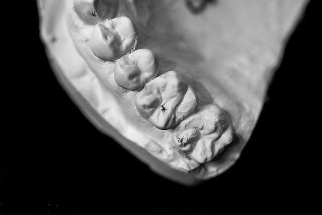 Dental Mold-7