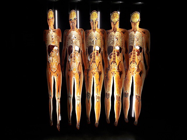 Body Slices from Body Worlds, photo Judith Schrut