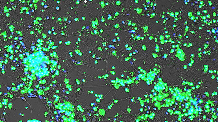 Cortical neurons decorated with a selective fluorescently labelled  a-syn peptide