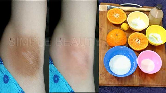2681 12 Effective Tips to get rid of Dark Underarms 04