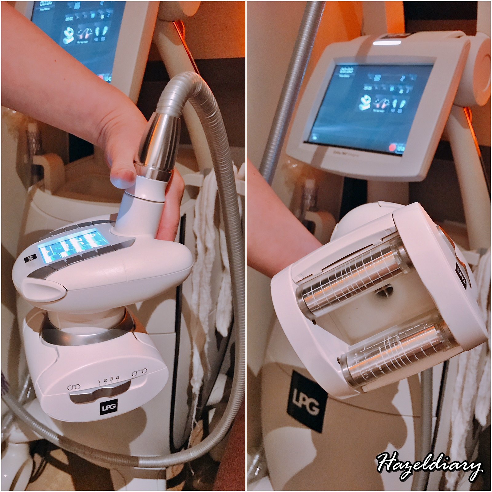 D'skin and Shou slimming Century Square-LPG Treatment