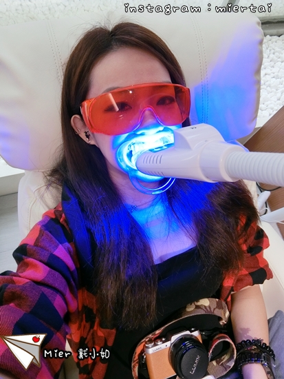 Dr.Min牙齒淨白推薦-桃園牙齒淨白推薦