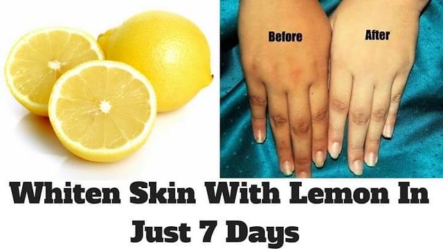 2665 4 Benefits of applying Lemon Juice on Skin 01